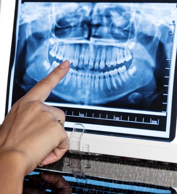 Dentist pointing to all digital x-rays