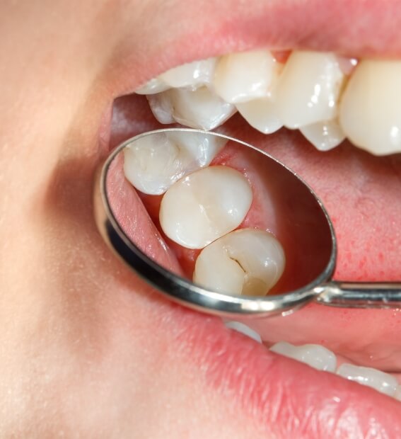 Dentist examining smile after soft tissue laser dentistry treatment