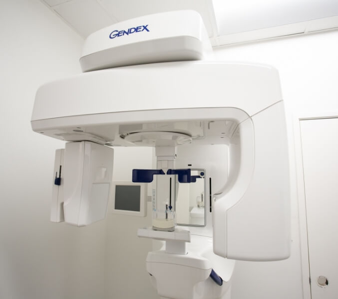 3 D C T cone beam digital x-ray scanner
