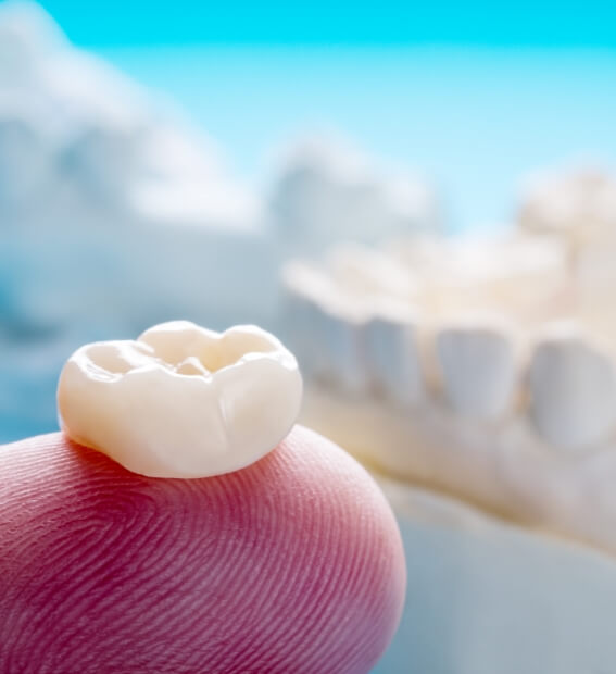 Dental crown resting on fingertip prior to placement