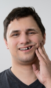 Man with missing top tooth